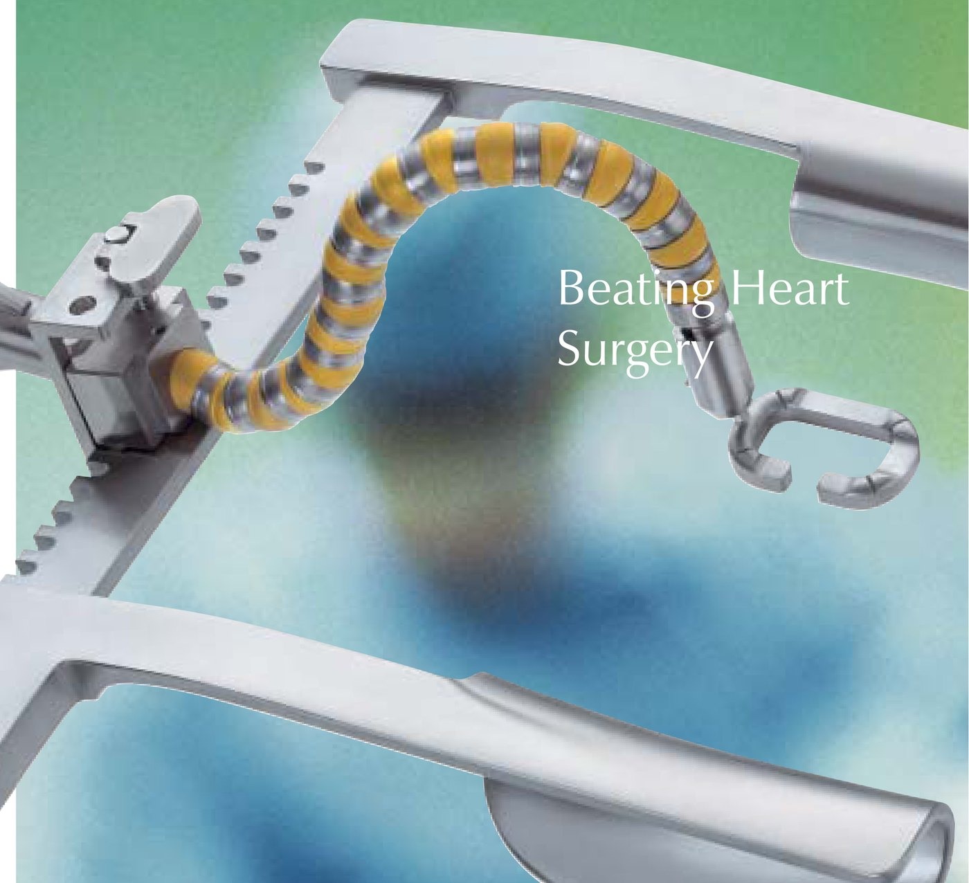 GEISTER stabilization flexible arm for beating heart surgery